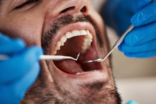Best Dentist for Dental Trauma  in Sparta, MO